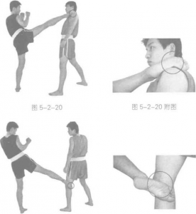 圖片100